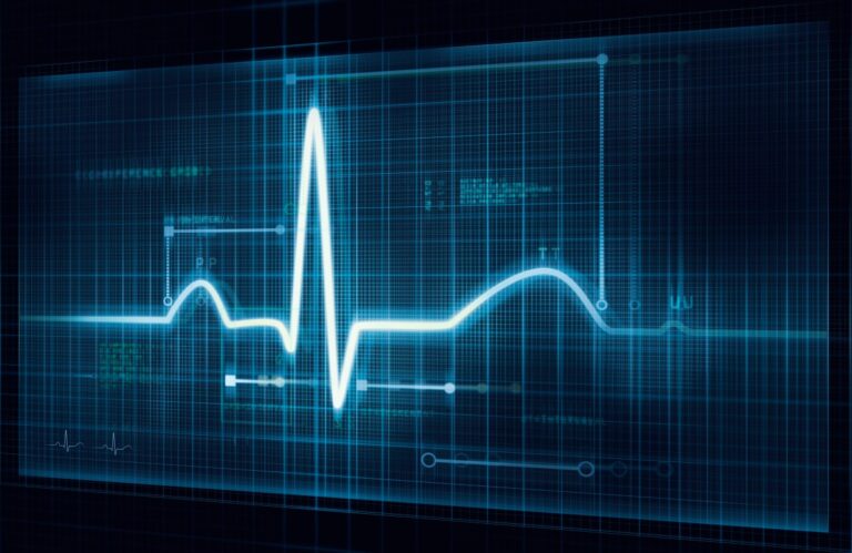 CardioComm, a provider of ECG monitoring devices, confirms cyberattack downed its services