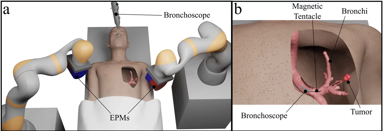 a Overview of magnetic tentacle delivery bronchoscope and actuation system comprised of two robotic arms, each controlling the pose of an external permanent magnet (EPM). b Magnetic tentacle deployment and laser delivery to a targeted tumor. c Illustration of the tentacle delivery system and sensing. d Schematic of the magnetic tentacle showing the integrated shape sensing Fiber Bragg Grating (FBG) and laser fiber.