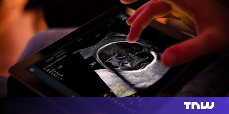 Samsung completes €86M takeover of French AI ultrasound startup Sonio